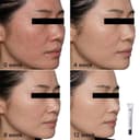 Mela W Corrector 20ml thumbnail 5